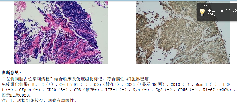 截图 免疫组化.png