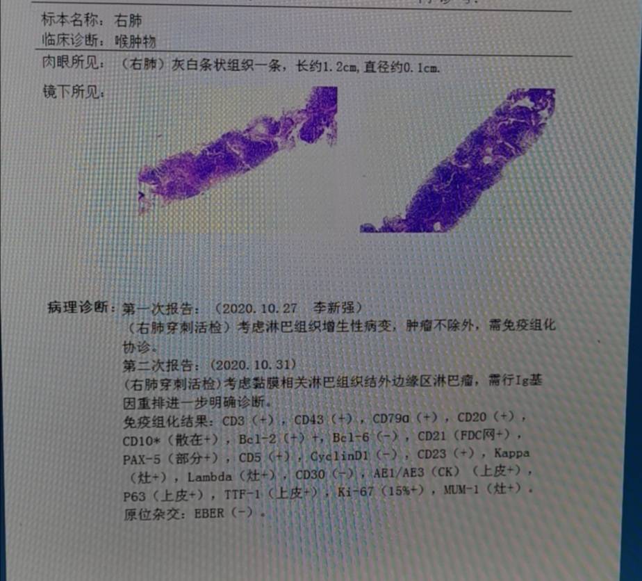 235614rhpt55vv7vr5tvqf.jpg