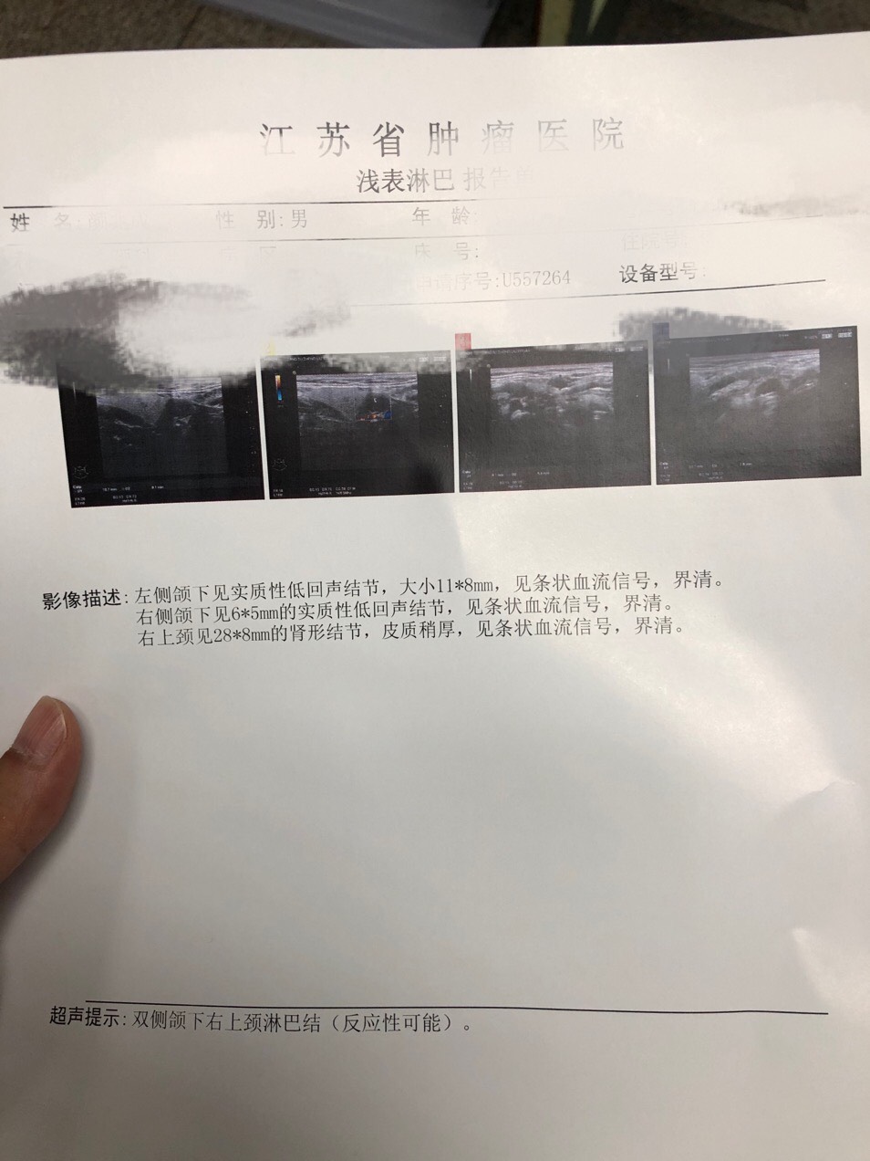112608ev7uz18svjpqk7bv.jpg