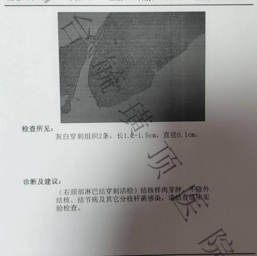 130116cr2tzm8zp8krtpgc.jpg