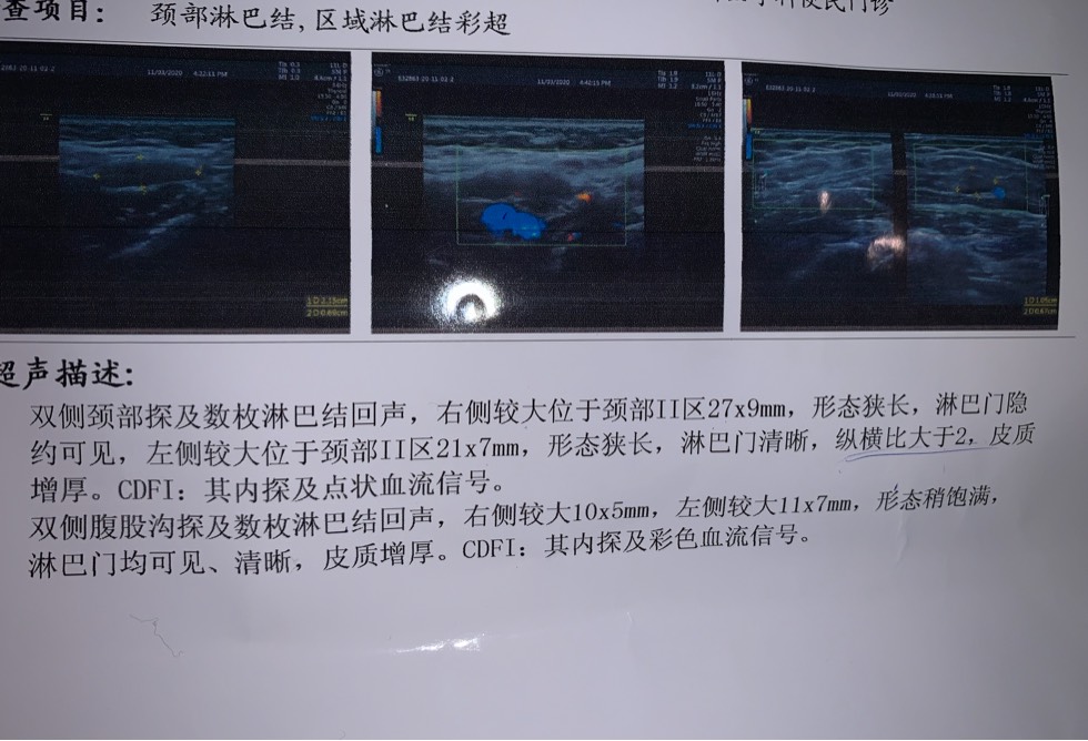 211857od6q66xfn6usgwkq.jpg