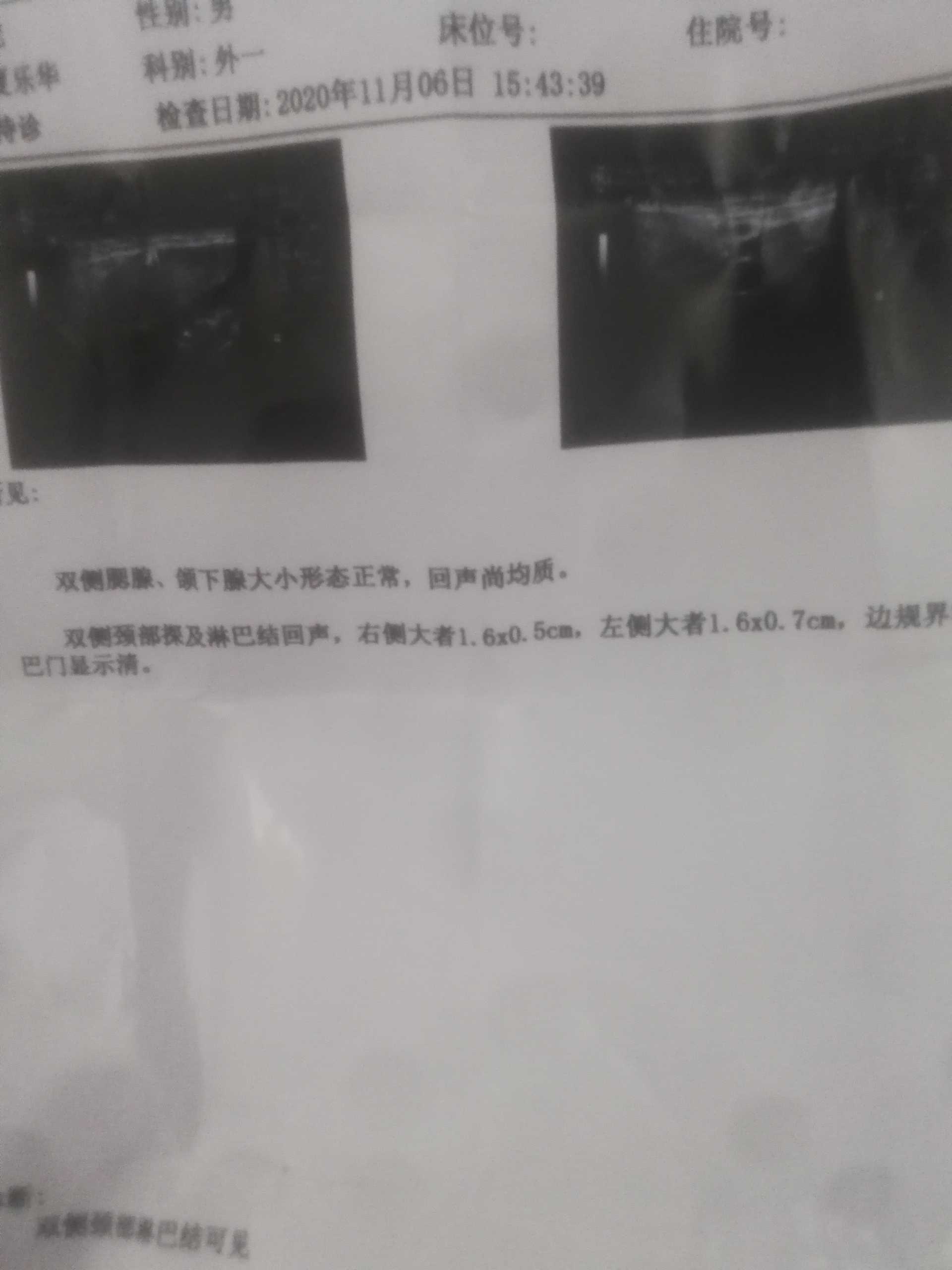 082715hkoukauzbuug9oa2.jpg