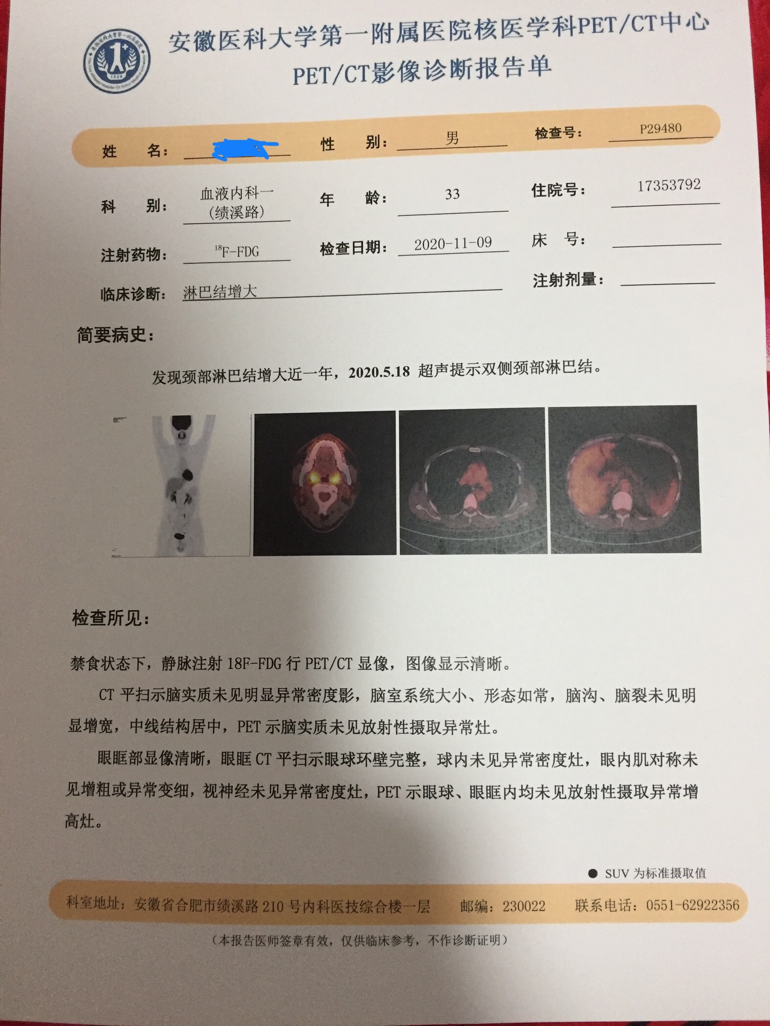190446rweeklei6elkcgb7.jpeg
