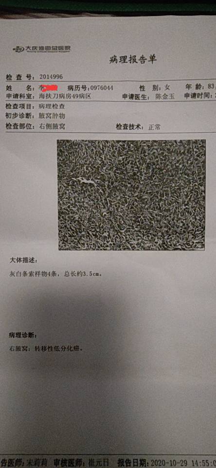 221512lyp66smitdmxpoec.jpg