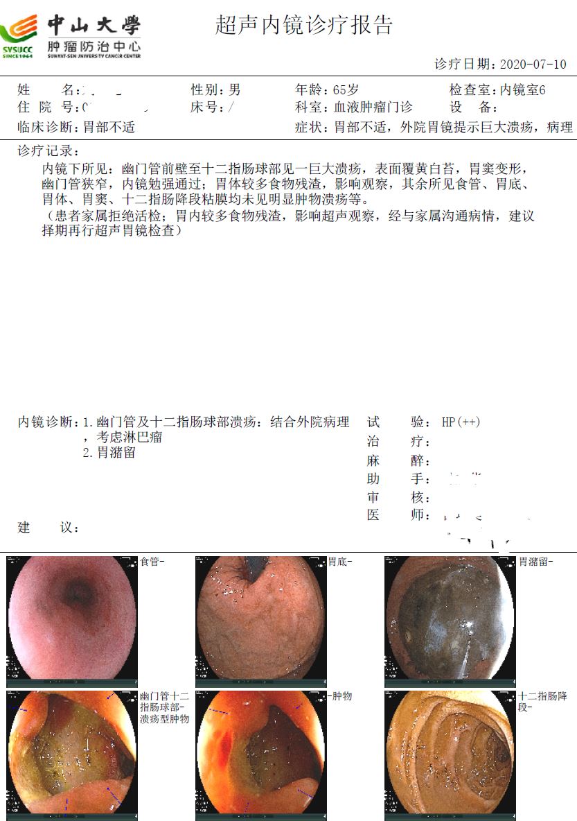 第一次胃超声