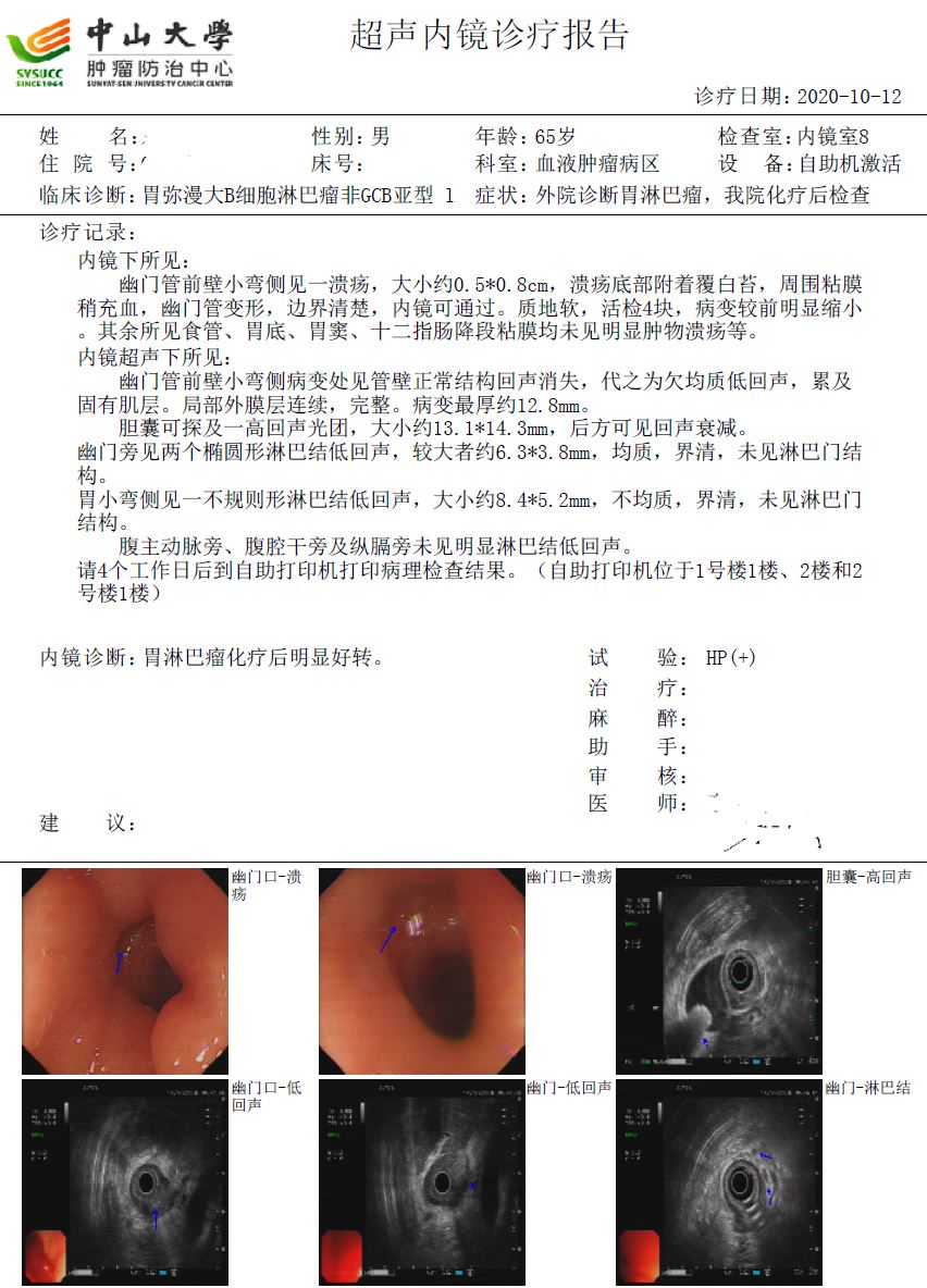 化疗4次后胃镜