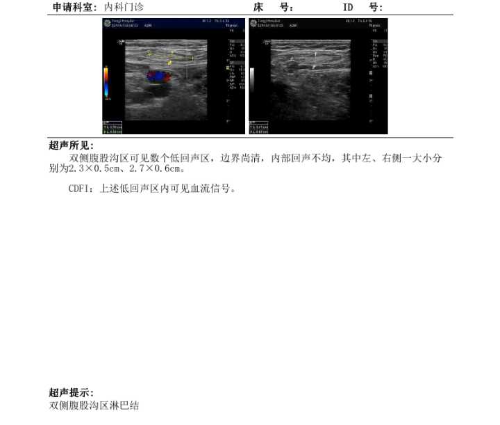 135319ojj56fgjphg5hppq.png