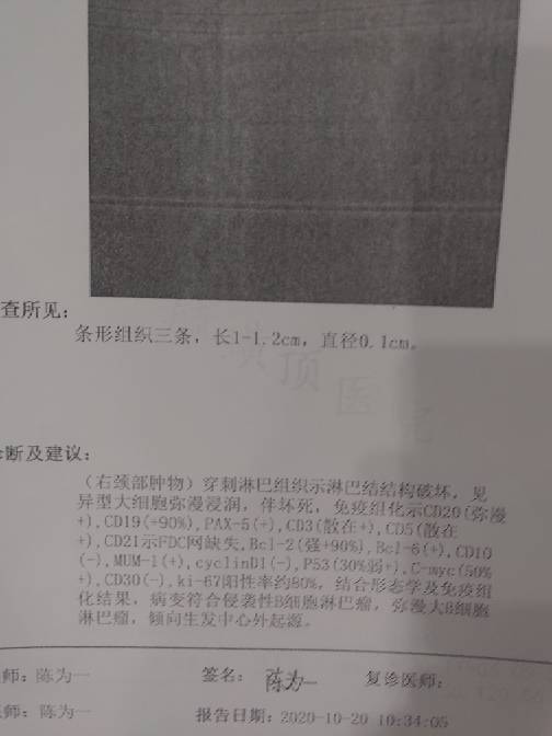 184935dkkpnzp7e2xpefq2.jpg