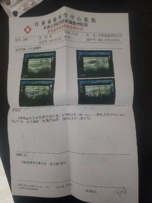 152003dcvx1zxc8d11m0bm.jpg