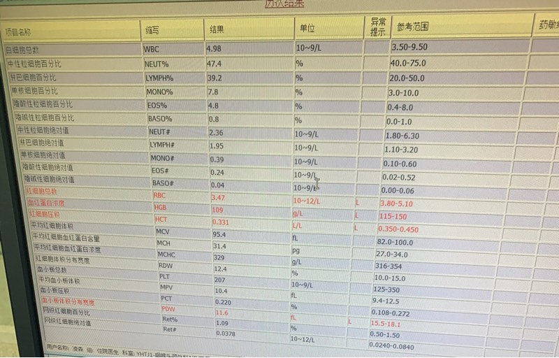 124207egm4sllgnzm7kpwd.jpg