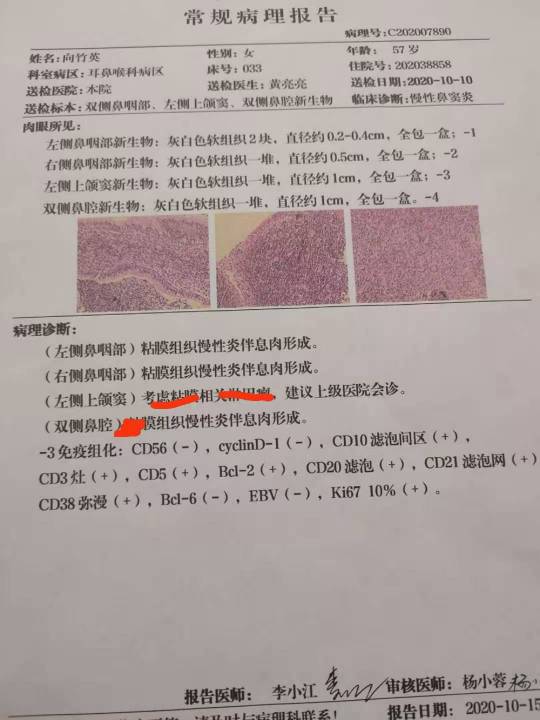 190545hcka0sqc030b8fac.jpg