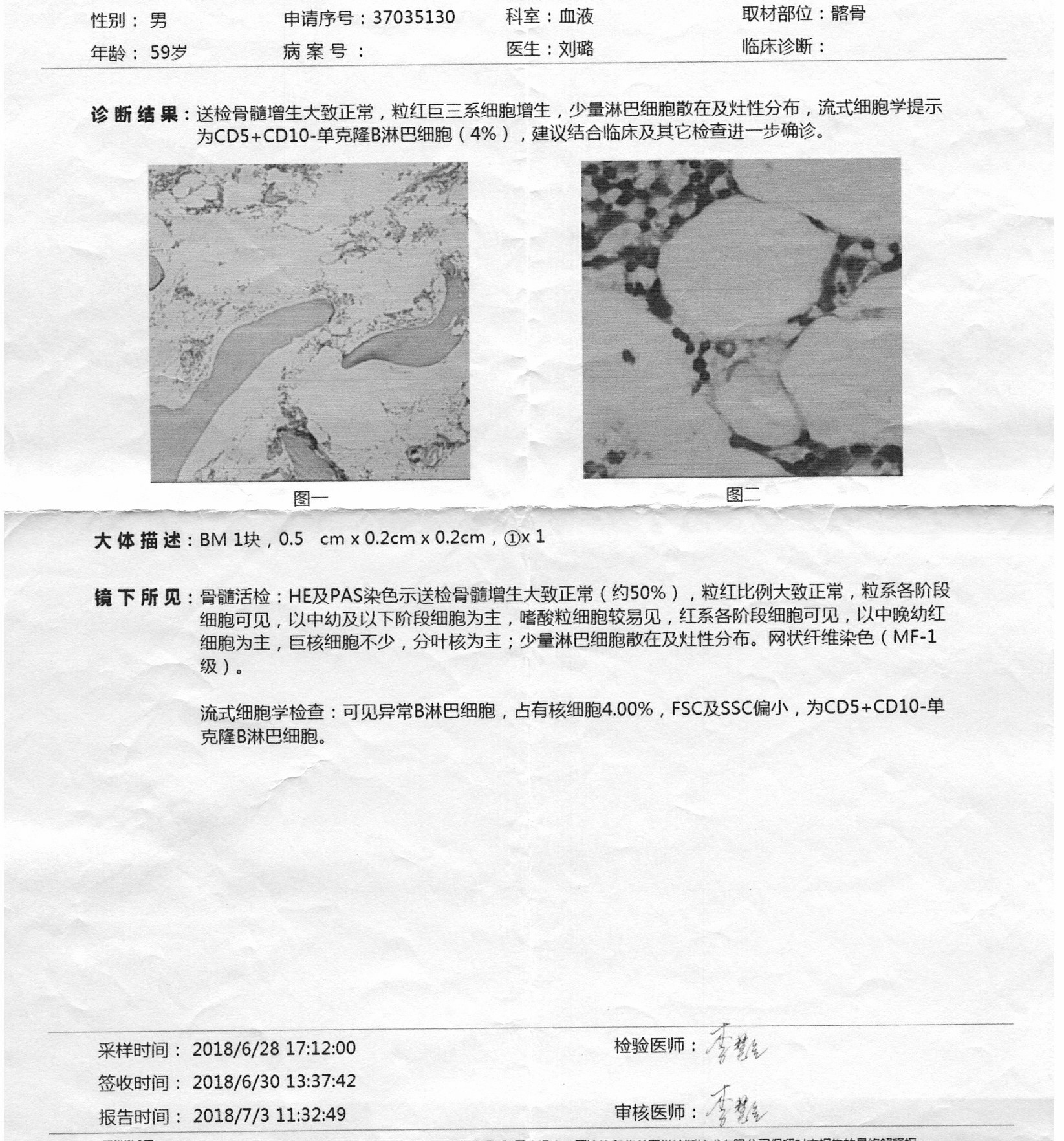 骨髓2018.jpg