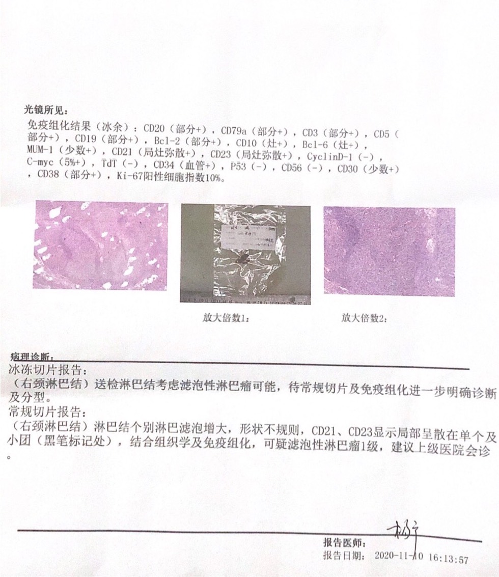 210358chb88lo6hl8jxxlb.jpg