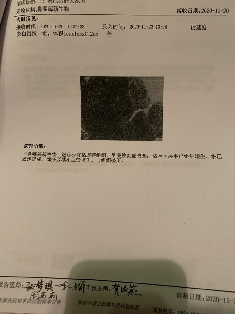 113506nm6s8jzuhj6mue2g.jpg