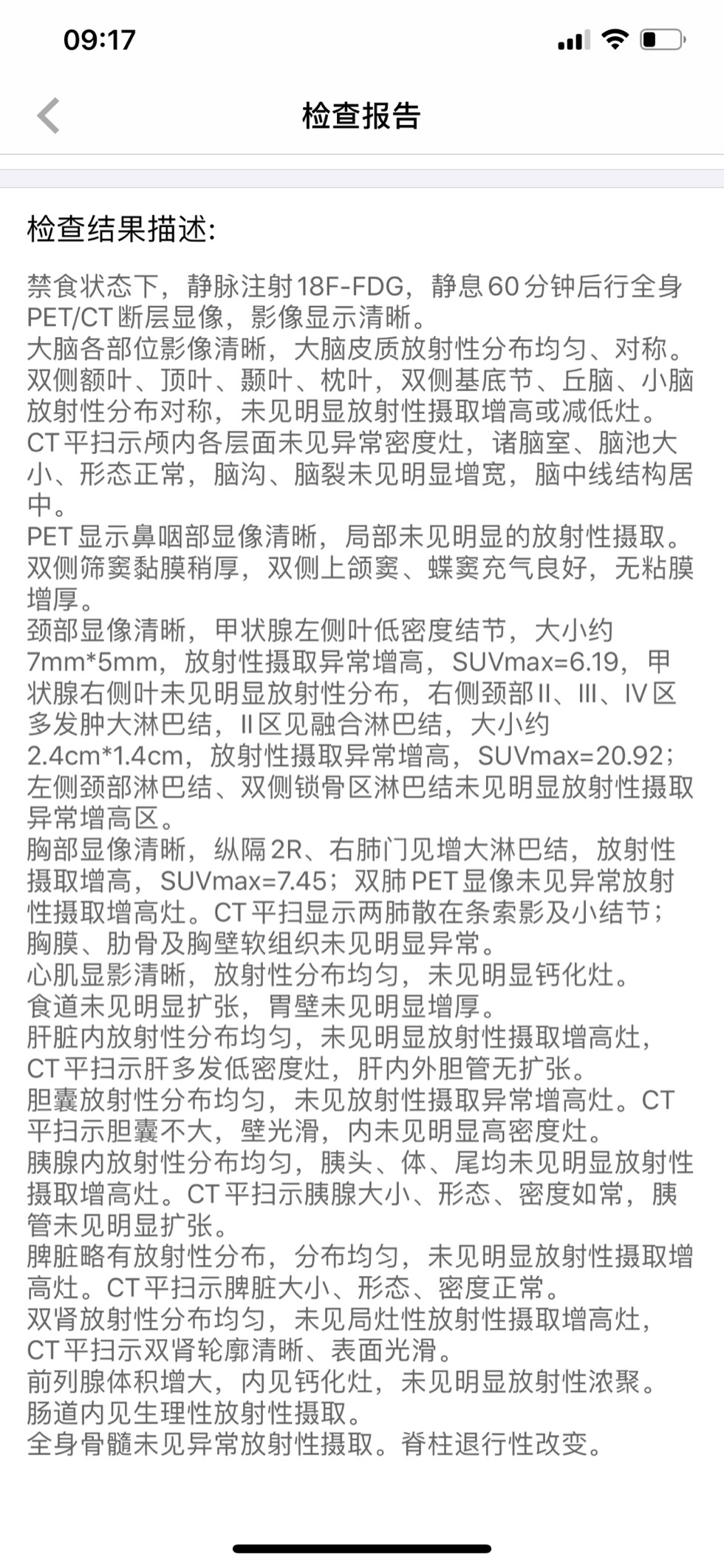 210956n2mlzlj12vap2zfl.jpg
