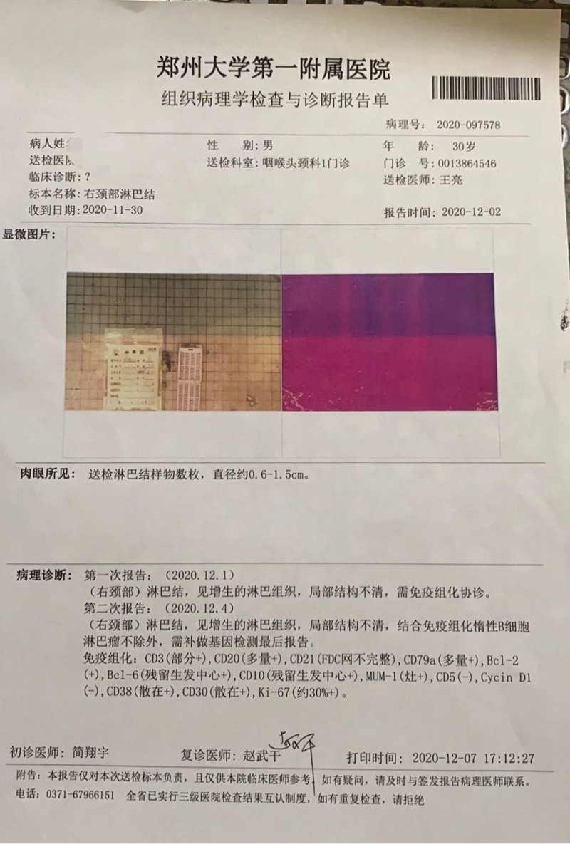 152522oca0itivi9j0ipii.jpg