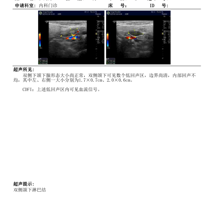 142105p99czl9ni1cii1k9.png