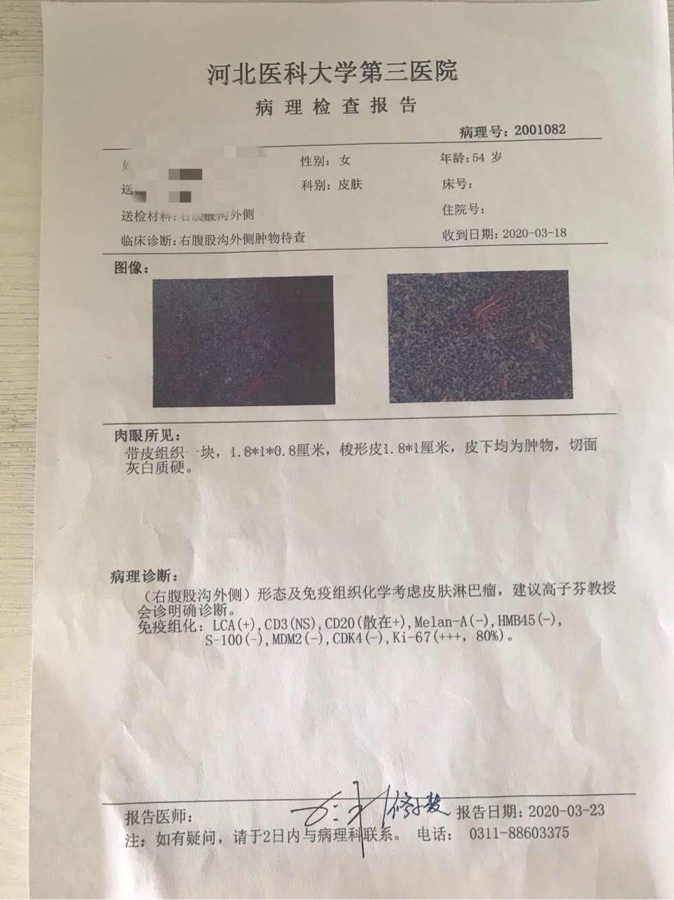 155800p3v8qs8x52qjcky9.jpg