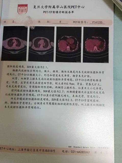 153036k6c2fyyo6on4123q.jpg