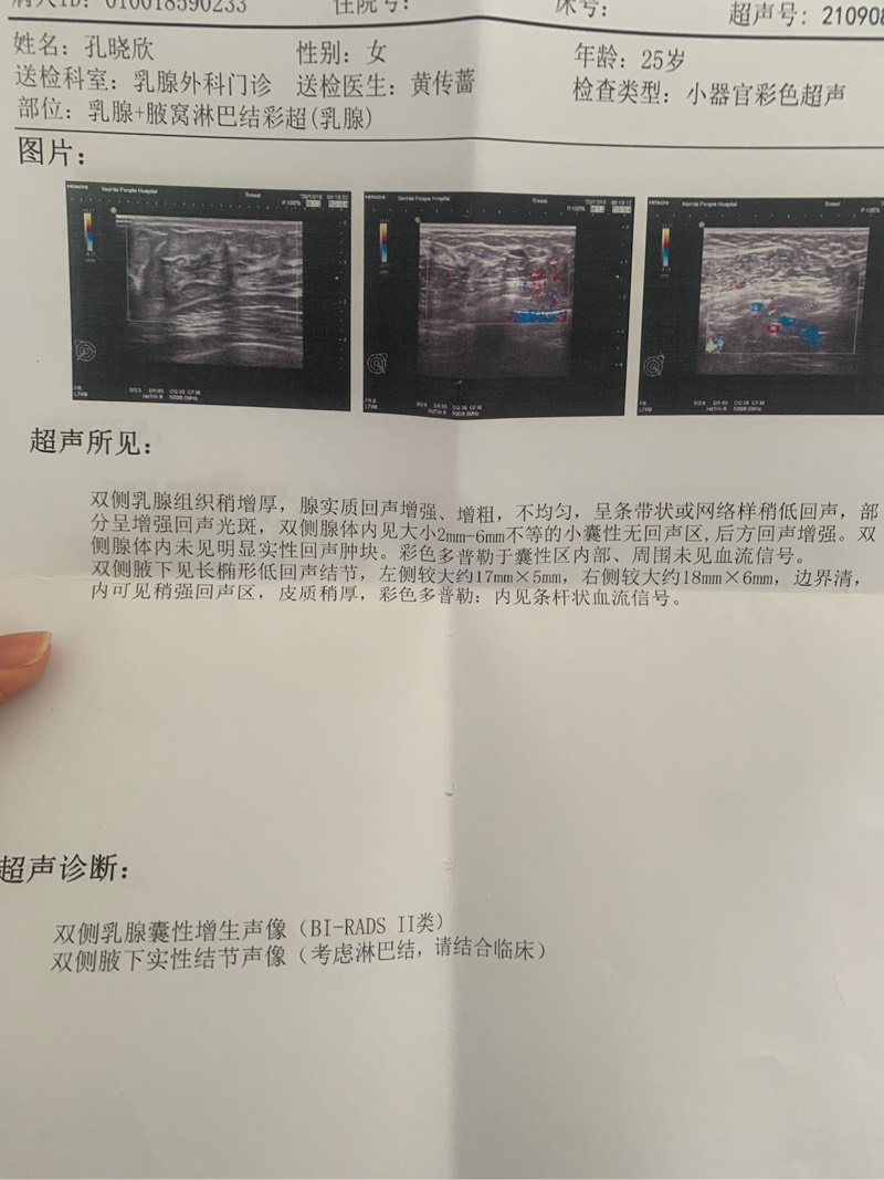 144025gi5155x21fvhczc5.jpg