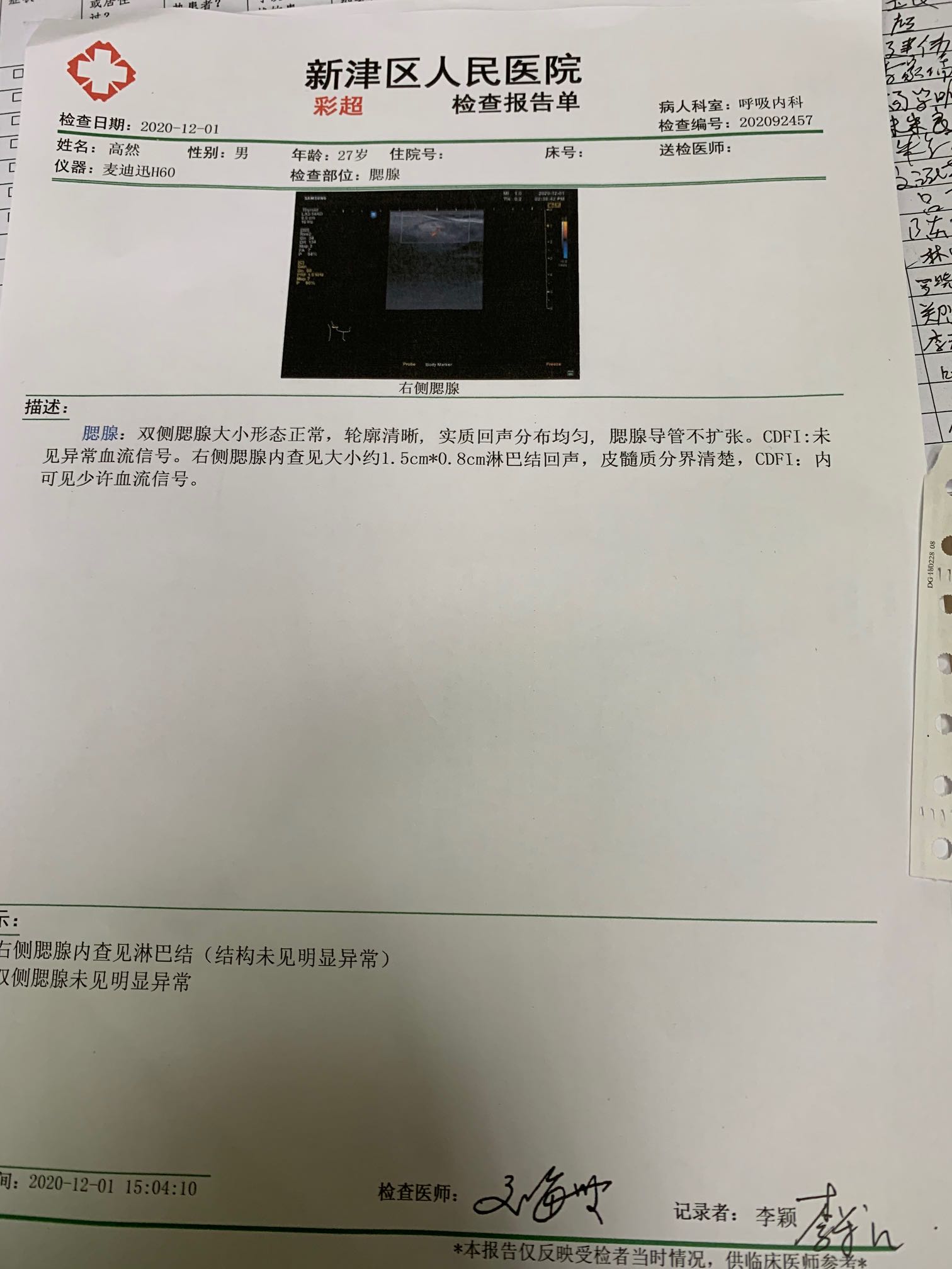 101219q3lu7pllupunlxiw.jpeg