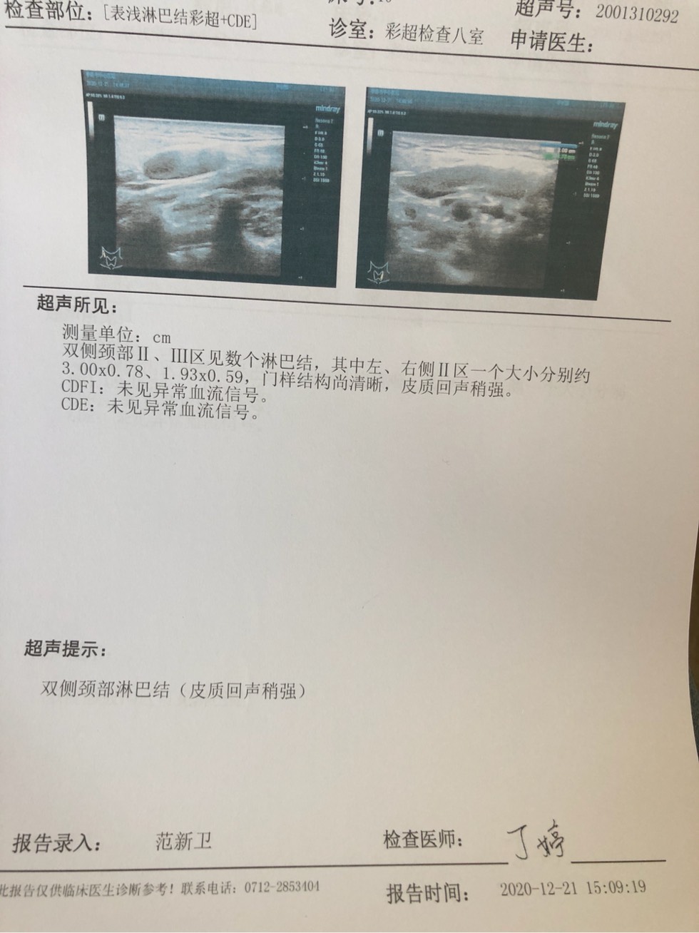 175923nf5742ynpns49n9q.jpg