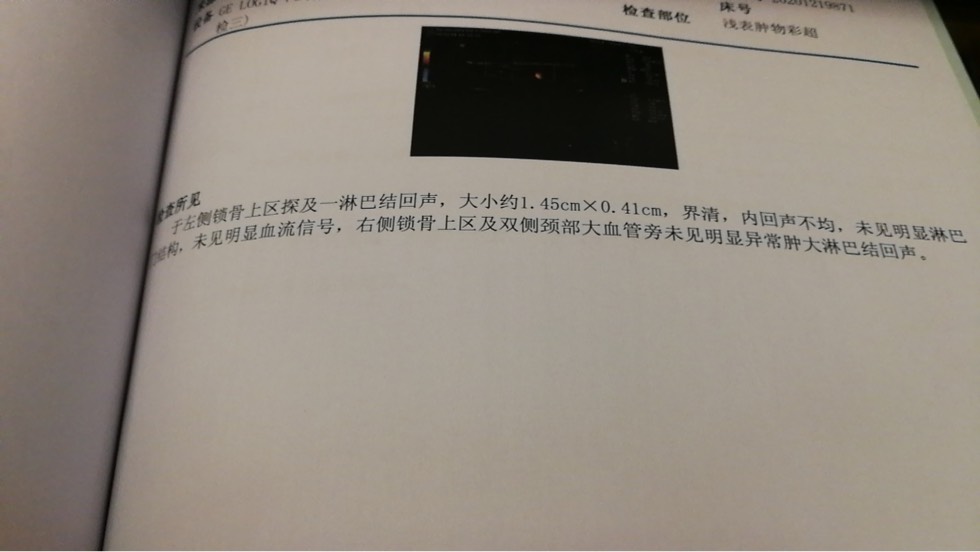 123211y6ej301p1jrkn3pe.jpg