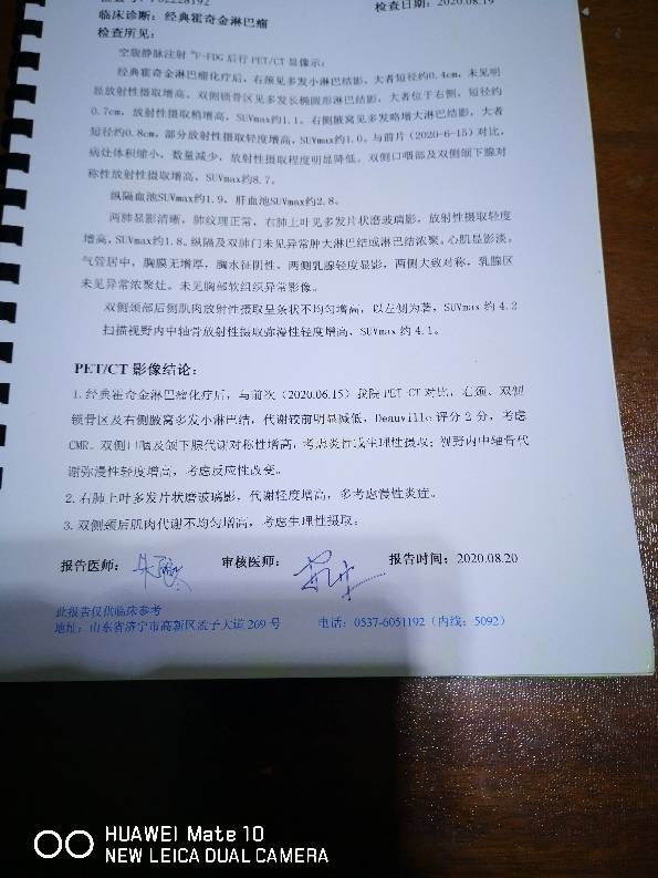 180027nbo65fb6zb00w665.jpg