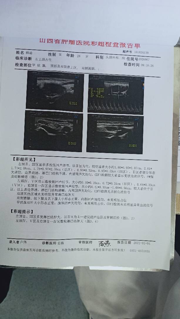 142035kdk0d6ooh03ezxa7.jpg