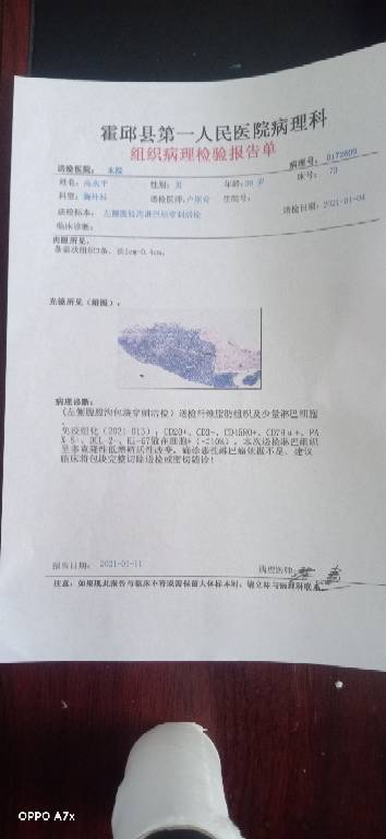 115125cn0f69pvj549zv6v.jpg