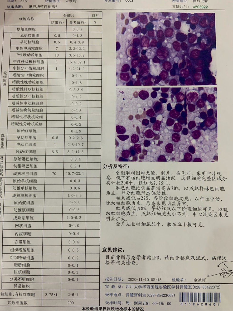 092120qgg6kiu4gs6h060m.jpg