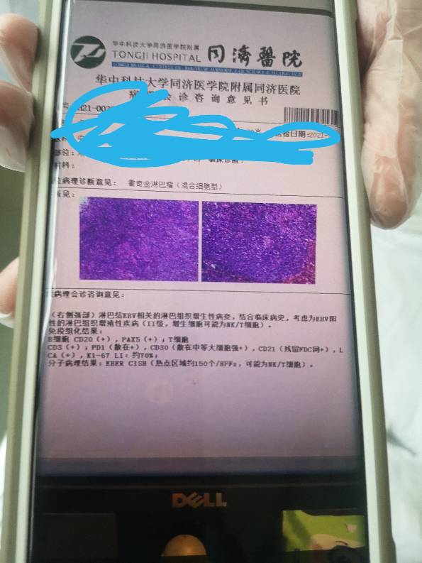 204108aq1rbbm71nfdmqmb.jpg