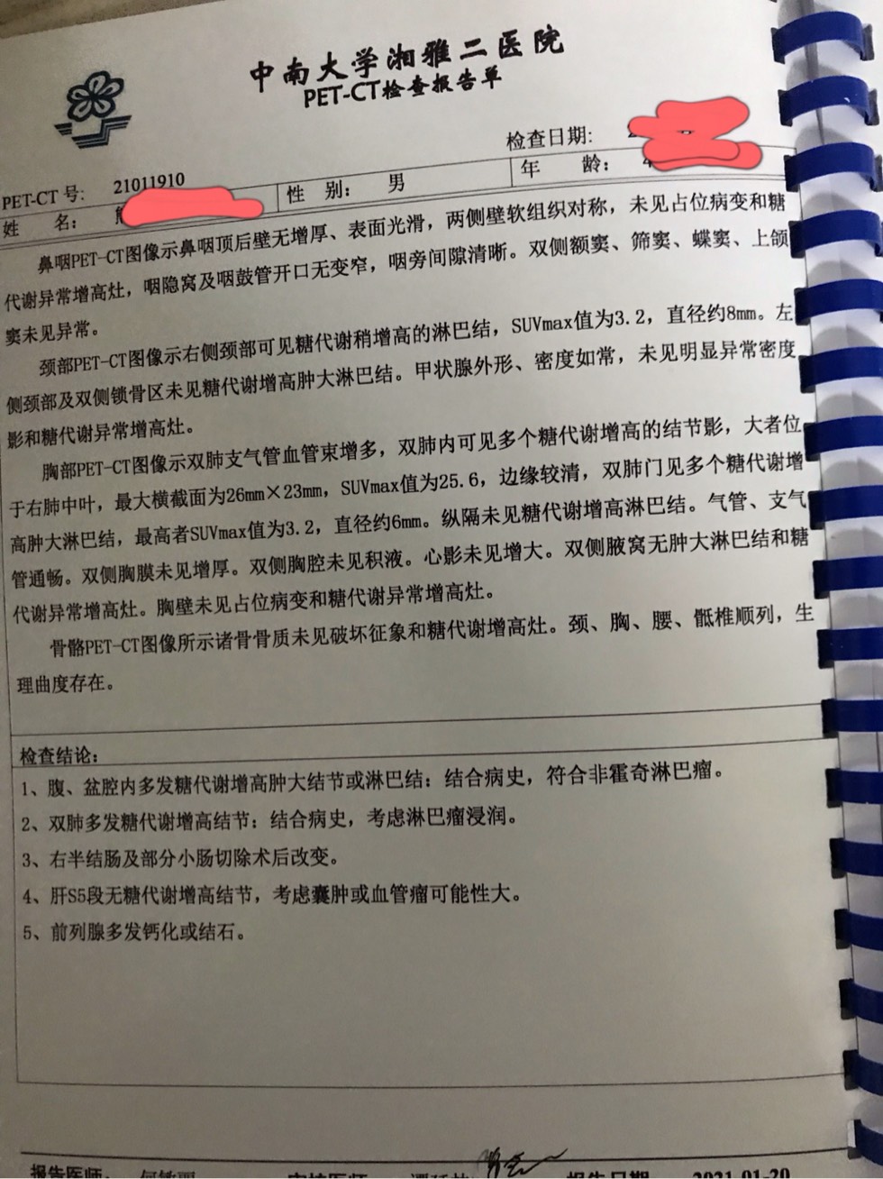 125927ebbwxu7z8f0owabi.jpg