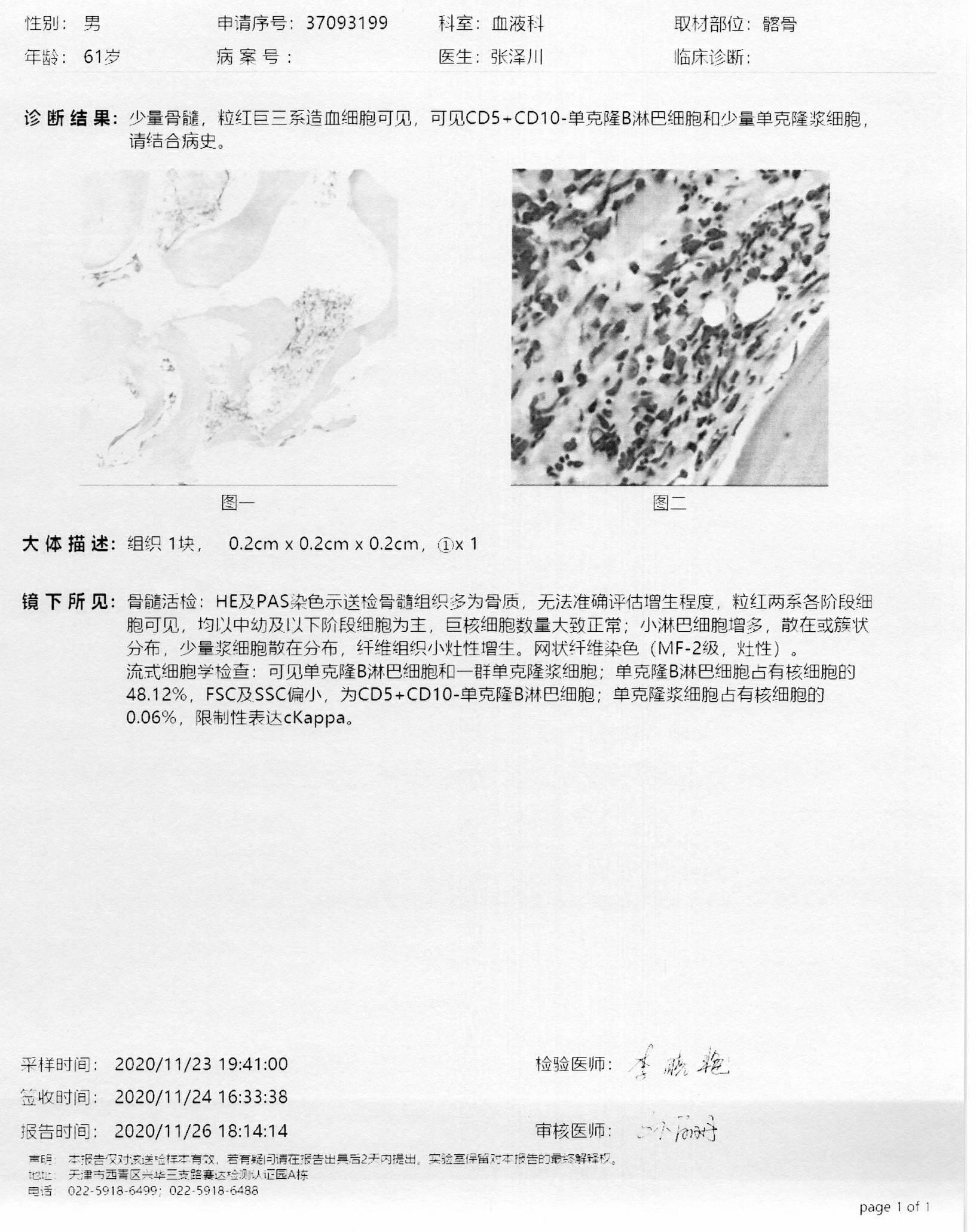 骨髓活检2020.11.jpg