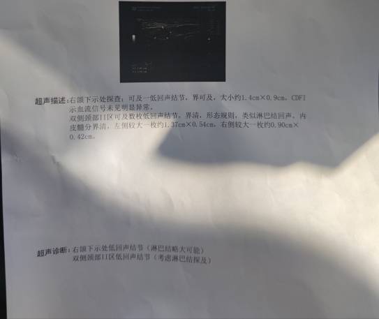114425kp64kjaku9nqfnpn.jpg