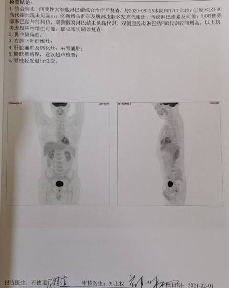 094007yi242cpacm3m2ot2.jpg