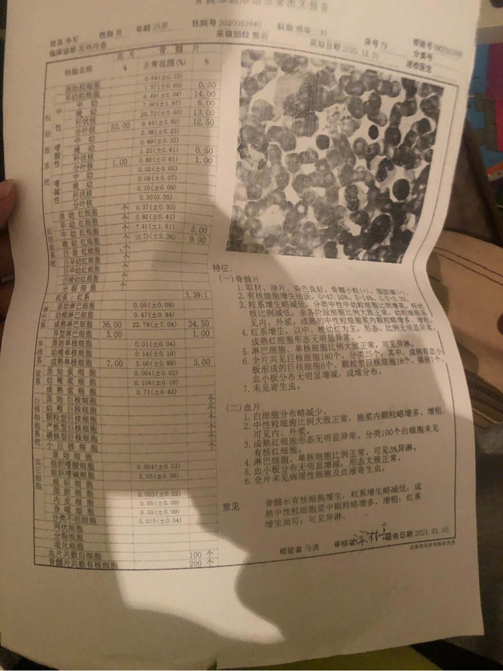 141115alpel2l5mleeal7p.jpg