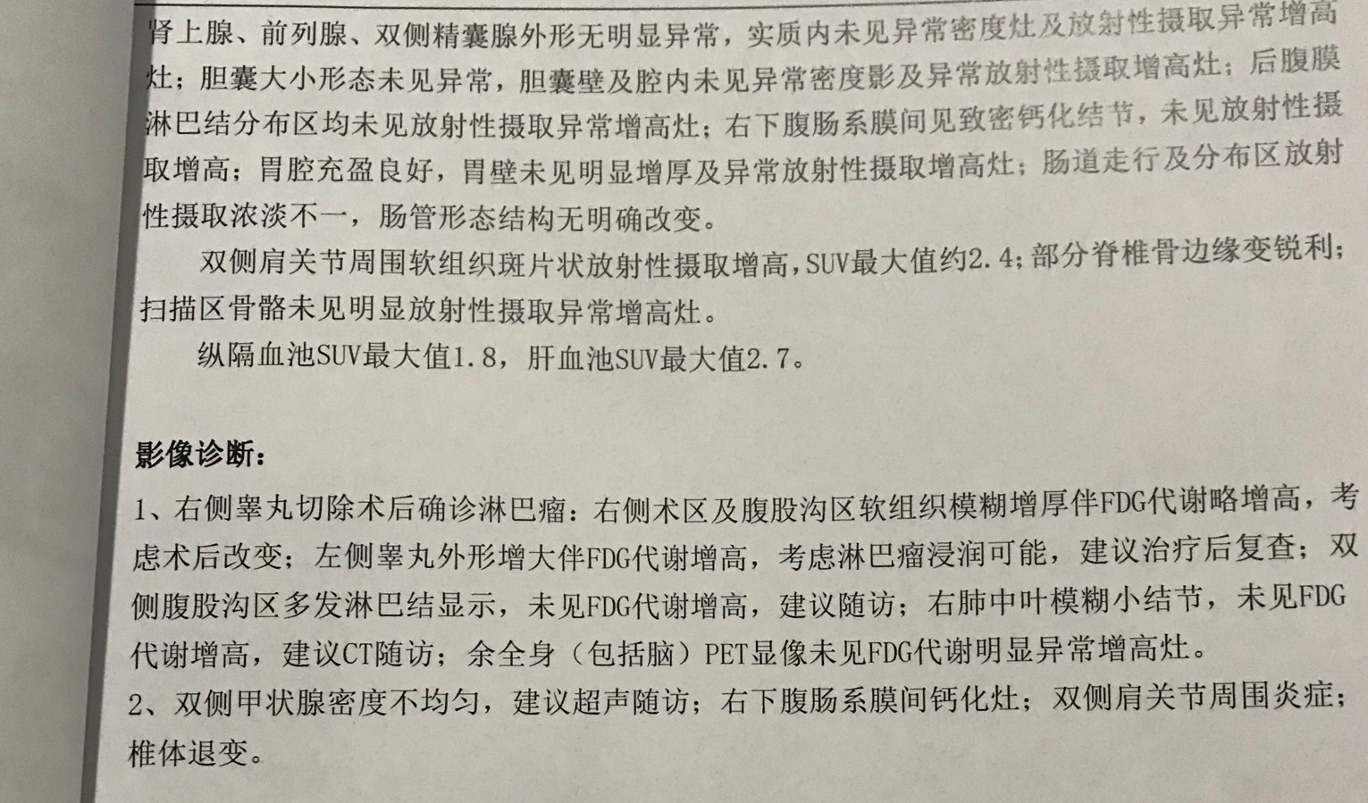 免疫组化