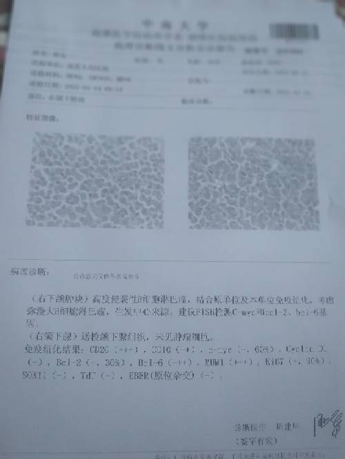 161703az5715zbibr4rcuz.jpg
