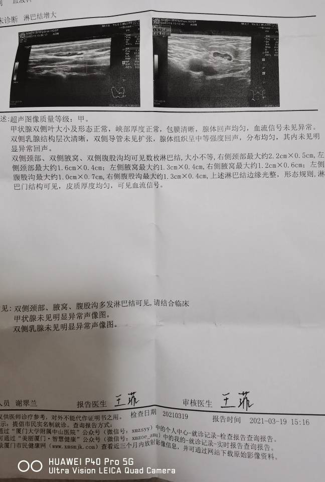 172839vks2284s6ssw4mss.jpg