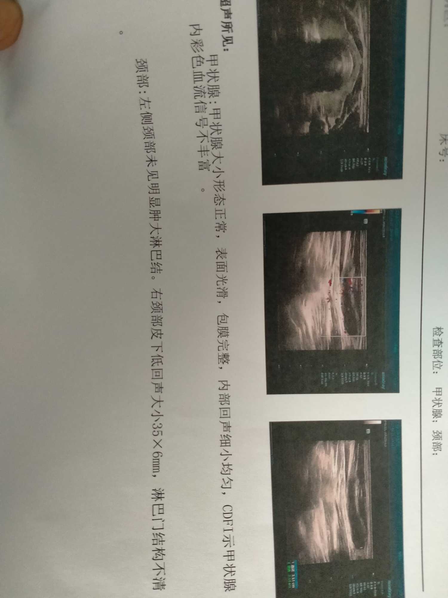 164433f1xnf3qzq43kz0c9.jpg