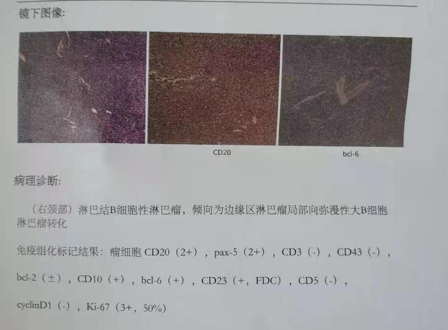 病理报告