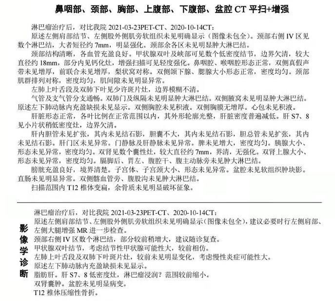 4月19日增强CT结果