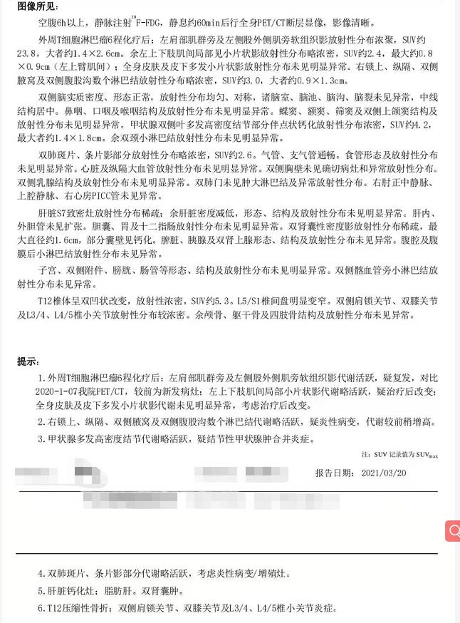 3月20日PETCT结果