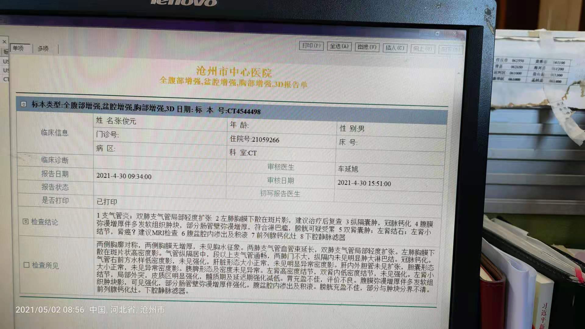 淋巴瘤2.jpg