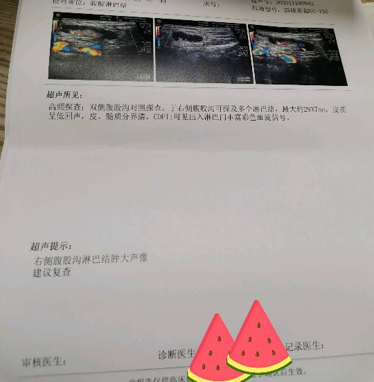 190520aerlsjlgsgldn6vv.png
