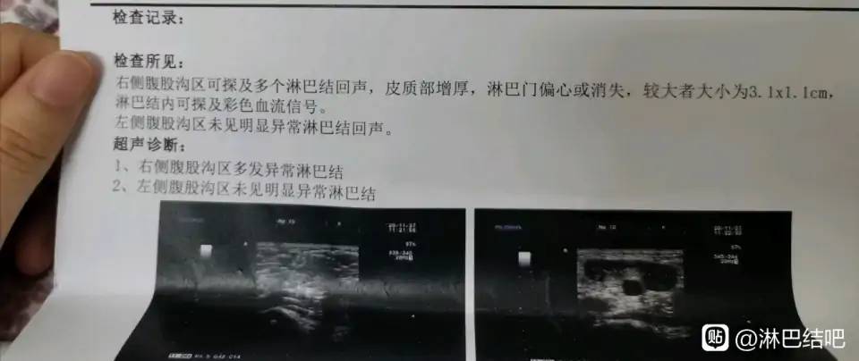 190521l3j87zyv8a1ydm3j.jpg