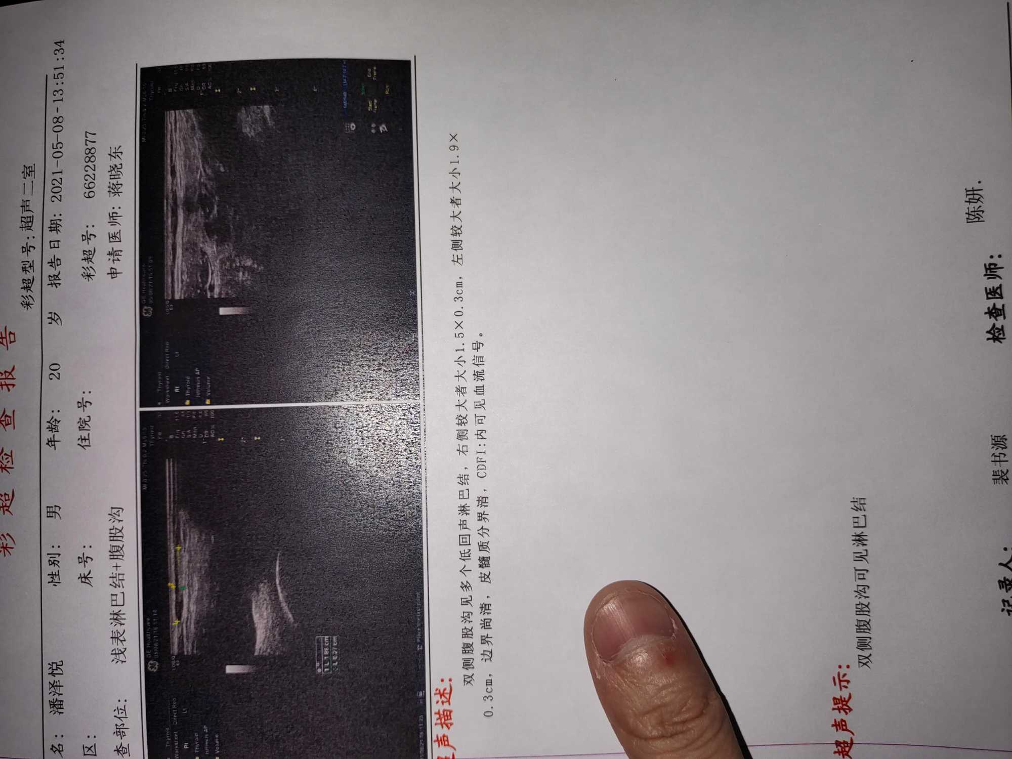 101357ivaexewx7va2lw26.jpg