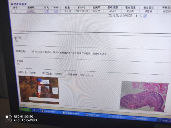 104133o9q05lpnrl9656qs.jpg