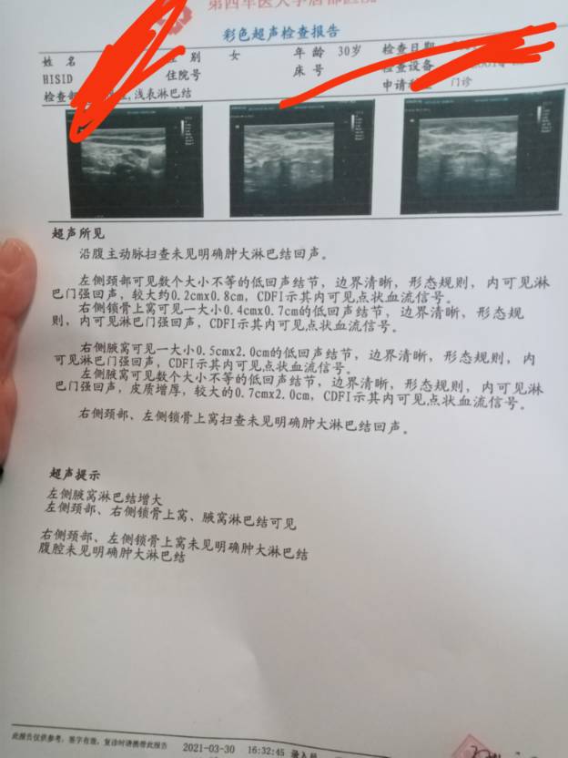 140151g5yaawgizssr22ei.jpg
